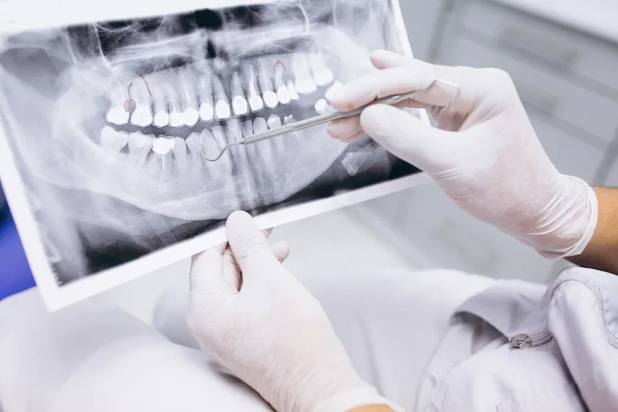 Dentist reviewing a panoramic dental X-ray
